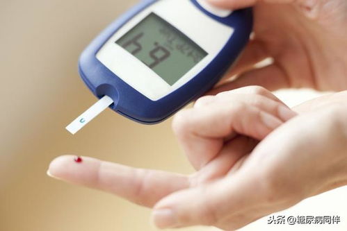 糖尿病患者的血糖监测